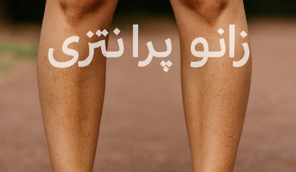 زانو پرانتزی